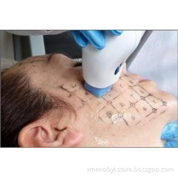 200v Vertical Microneedle fractional radio frequency wrinkl
